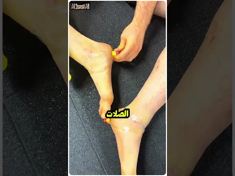 لماذا يضعون البيضة تحت أقدامهم؟