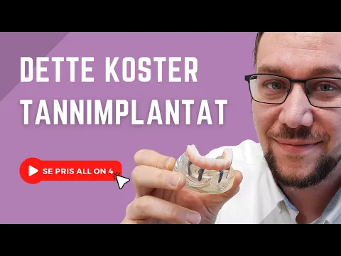 Pris på All on 4 og tannimplantat: Her får du vite det.