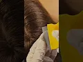ASMR Lice found while brushing hair with metal comb