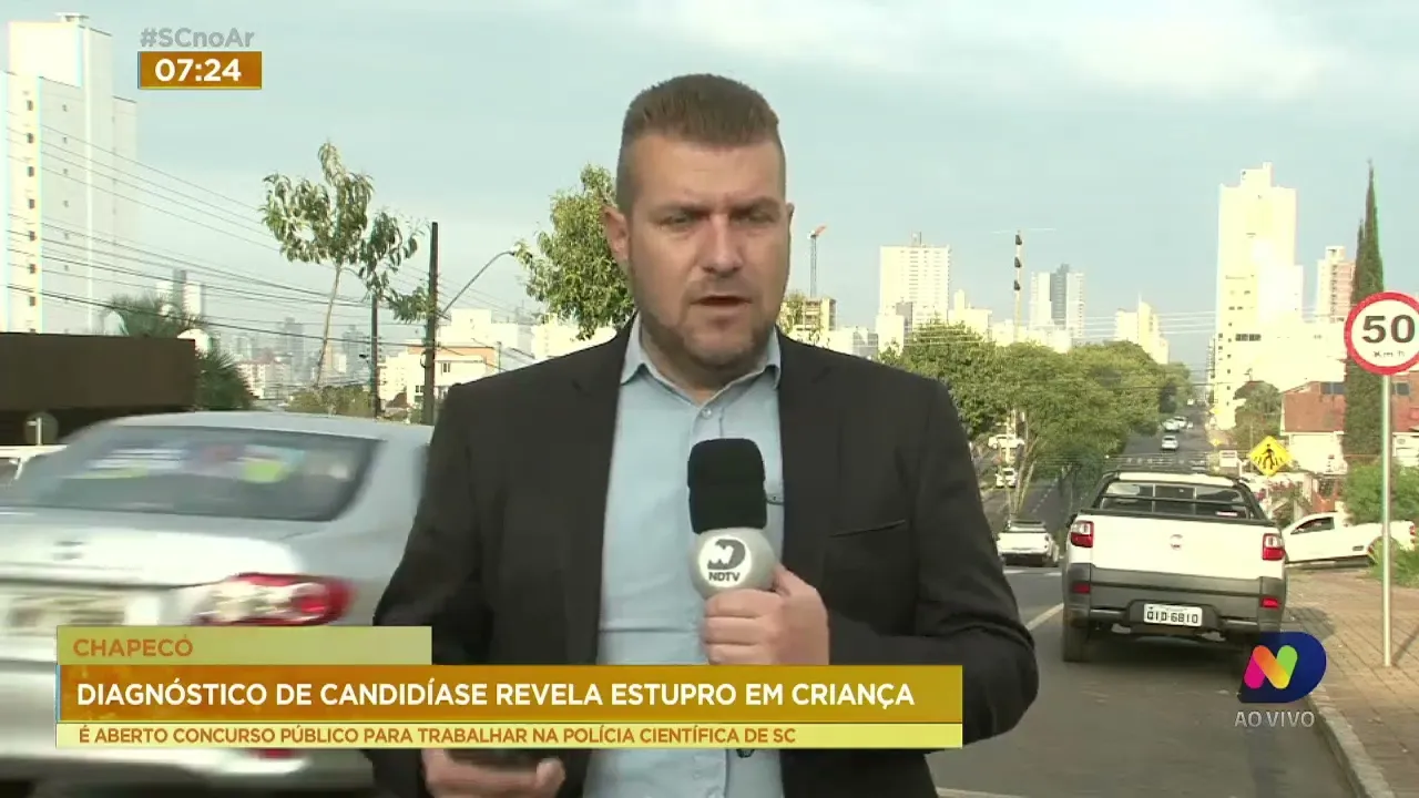 Exame que detecta candidíase revela estupro em criança na cidade de Chapecó