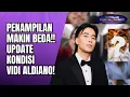 Lagu KONDISI TERKINI VIDI ALDIANO DI MAROKO! BERJUANG LAWAN KANKER MESKI EFEK OBAT KIAN KERAS!! - OSS