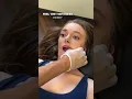 TMJ Treatment Massage Adjustment for Jaw Pain Jaw Clicking Jaw Tightness by Best Chiropractor