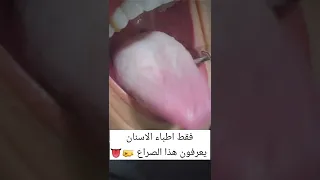 صراع طبيب الاسنان مع لسان المريض 