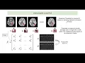 Denoising - PCA based Denoising Local PCA and MPPCA