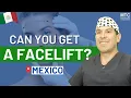 Who Should Undergo Facelift Surgery - Mexico Plastic Surgeon