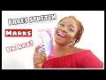 GET RID OF STRETCH MARKS BEST STRETCH MARK REMOVAL CREAM VEET GOLD CREAM REVIEWS