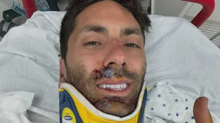 Catfish Star Nev Schulman Hospitalized After Breaking Neck in Bike Accident