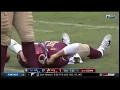 Alex Smith Goes Down With TERRIBLE Leg Injury