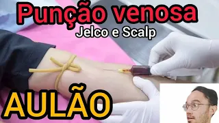 Punção venosa com jelco - punção venosa com scalp. AULÃO