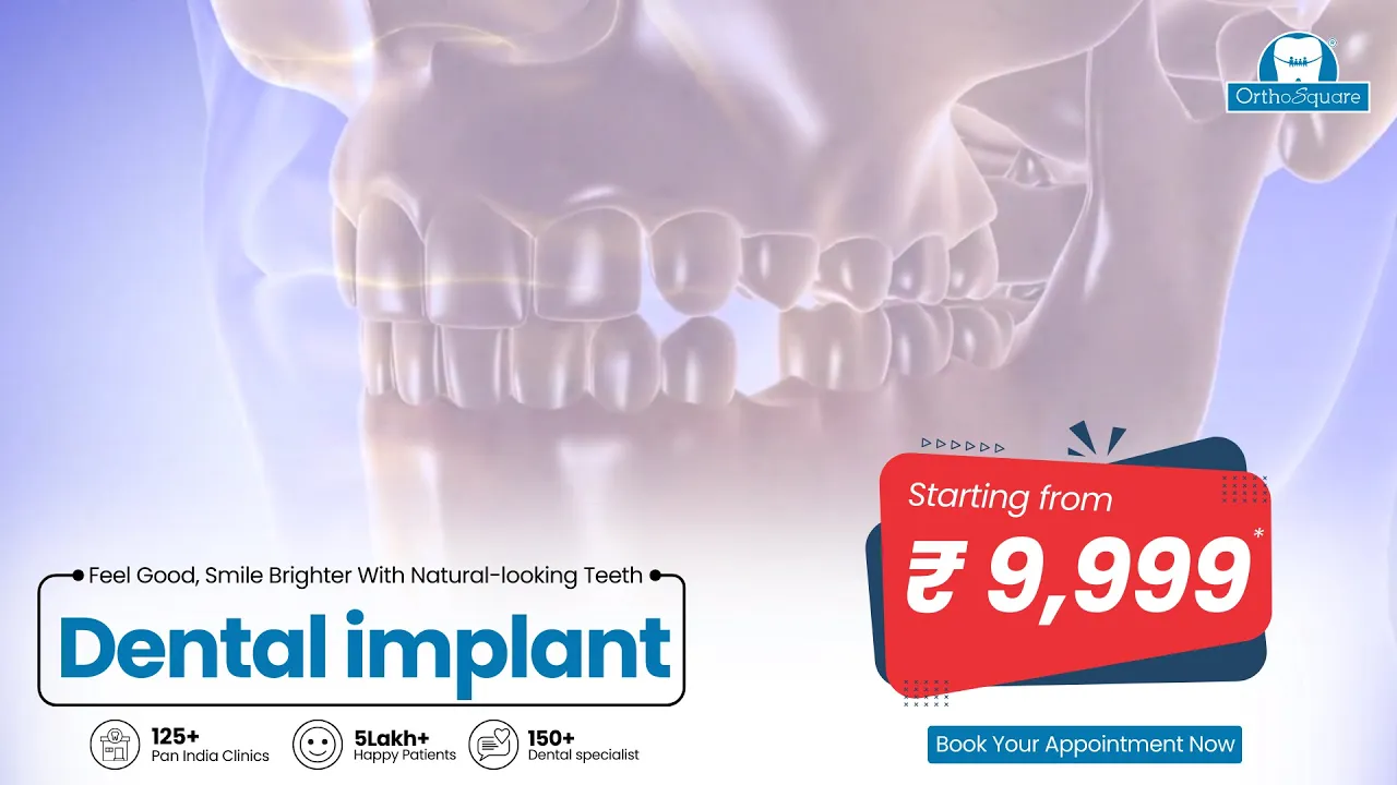 Orthosquare Dental Clinic — OrthoSquare — Dental Implants Starting from ₹ 9,999 (YouTube video ad)
