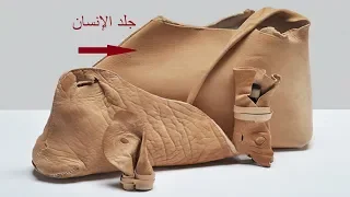 صدق او لا تصدق أغرب قصة من الخيال سيدة تح ول جلد ساقها إلى حقيبة يد 