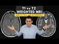 T1 vs T2 weighted MRI images How to tell the difference
