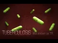 CDC Tuberculosis TB Transmission and Pathogenesis