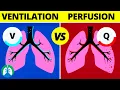 Ventilation-Perfusion Ratio Quick Medical Overview