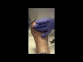How to treat thickened toenails
