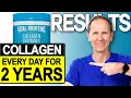 Vital Proteins Collagen Peptides Results After 2 Years