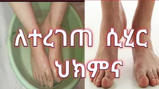 ለተረገጠ ሲሂር ህክምናው መፍትሔው 