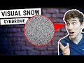 A Cure for Visual Snow New Research