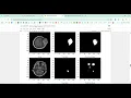 MRI Brain Image Segmentation using CNN in Python Projects