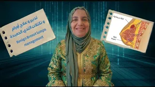 كيف تتخلصين من الولسيس الحميد من الثدي بوصفة فعالة من غير ج_را_ح_ة_