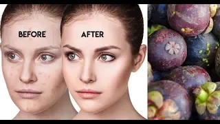 Mangosteen tea is one form of processed mangosteen fruit. You can consume mangosteen fruit in the fo. 