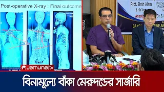 বাঁকা মেরুদণ্ডের চার রোগীকে বিনামূল্যে সার্জারি সেবা | Scoliosis in BD | News | JamunaTV