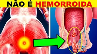 8 Sinais de CÂNCER de INTESTINO Que Parecem Hemorroida + DICA de OURO para EVITAR Câncer Colorretal