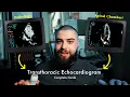 How to Perform a Transthoracic Echocardiogram TTE Step-by-Step Guide