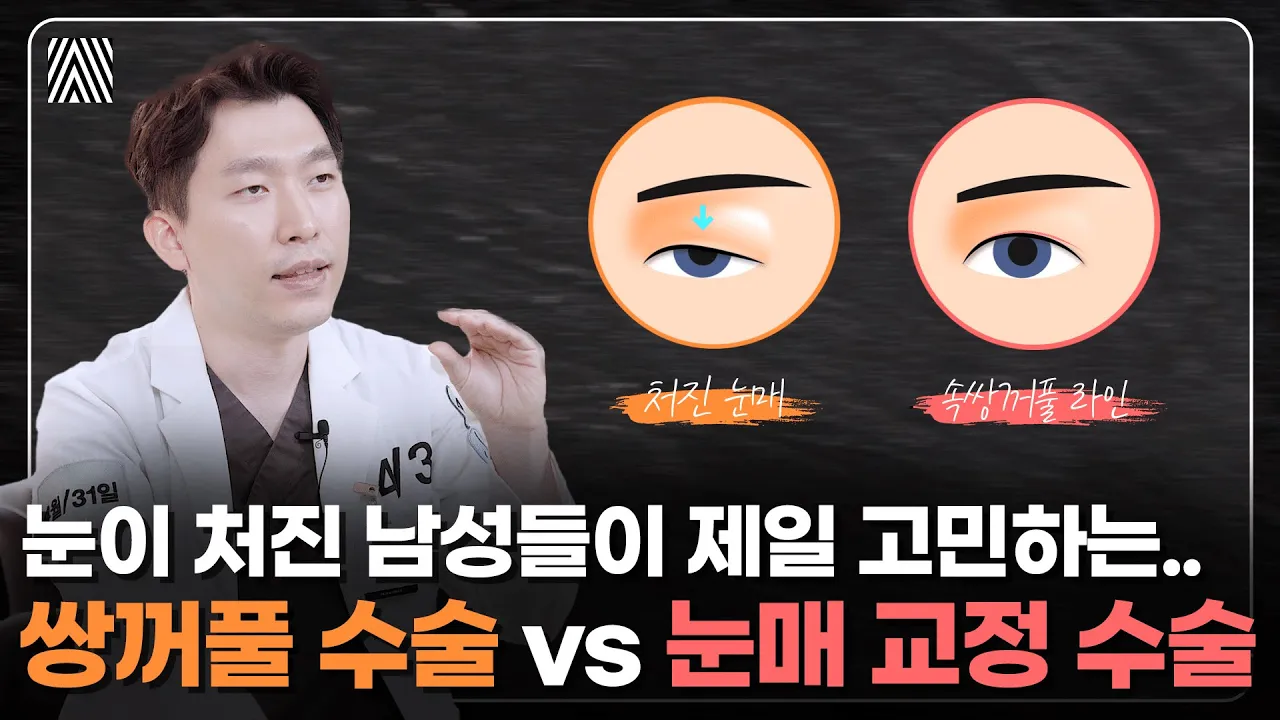 눈 성형 고민 중인 남자들이 꼭 봐야할 영상!! 느끼하지 않고 자연스러운 눈 성형 방법!!_[4월31일 성형외과]
