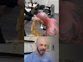 Dermatologist reacts to EXTREME waxing
