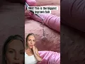 Download Lagu OMG! THIS IS THE WORLDS BIGGEST INGROWN HAIR REMOVAL! #shorts