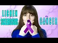 Lichen sclerosus and cancer