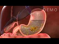 Download Lagu THE HUMAN DIGESTIVE SYSTEM OESOPHAGUS AND STOMACH v02