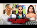 Beyonce s Surgeon EXPOSES Blue Ivy s Face Surgery