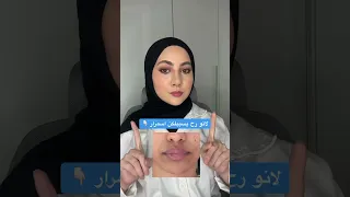 بتعانوا من اسمرار حول الفم                                        دندنها