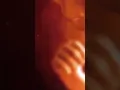 Download Lagu Musik Klasik Menenangkan Ibu Hamil \u0026 Bayi dalam Kandungan | Iringan Tidur Berkualitas #BayiCerdas
