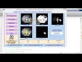 Kidney Stone Detection Using Image Processing Matlab Project Source Code