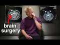 I'm Having Brain Surgery...