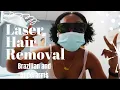 Laser Hair Removal Brazilian Underarms Ideal Image