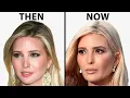 Ivanka Trump s NEW FACE Plastic Surgery Analysis