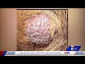 Download Lagu Cancer Symptoms in Pets | Lumps and Bumps