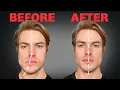 Download Lagu How to Fix Asymmetrical Jaw \u0026 Face (FOREVER)