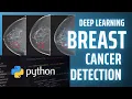 Breast Cancer Classification with Neural Network Deep Learning Projects in Python