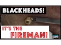Don t miss these huge blackhead extractions in The Fireman