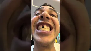 كليب   نولع   حمو بيكا و الباور العالي   حصريا   من البوم حكايه شارع      دندنها