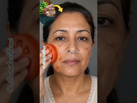 ✅Best Dark Spots Removal Hack/Pigmentation Spots Remove Naturally #shorts #pigmentation #darkspots