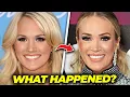 The Truth on What Happened to Carrie Underwood s Face