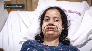 Jaw Surgery Plastic Surgery in Indian Girl | Best Case Study India