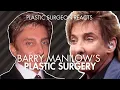 Barry Manilow Before and After Plastic Surgeon Reacts