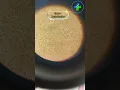 Download Lagu Semen analysis | sperm Agglutination | sperm under microscope | Sperm count | male fertility test
